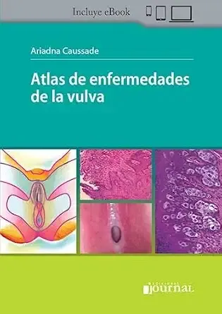 Atlas of Vulvar Diseases
