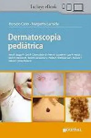 Dermatoscopia Pediátrica