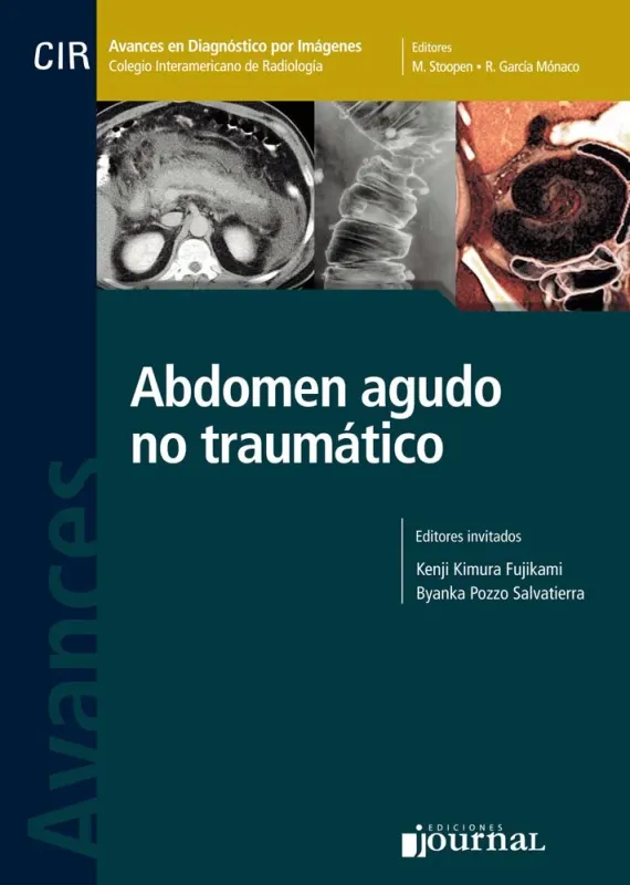 Diabetes Mellitus in Children and Adolescents (Spanish Edition)