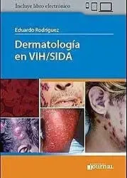 Dermatología en VIH/SIDA