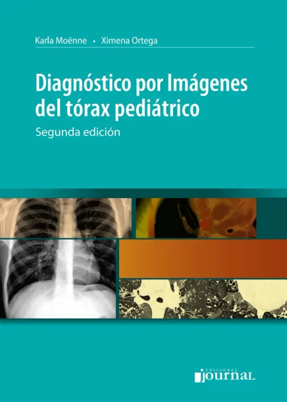 Diagnostico Por Imagenes Del Torax Pediatrico, 2nd Edition