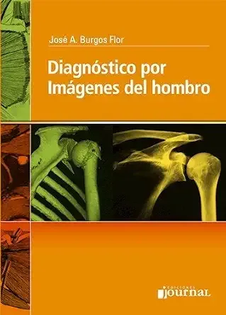 Diagnostico Por Imágenes Del Hombro