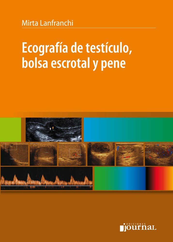 Ecografía de Testículo, Bolsa Escrotal y Pene