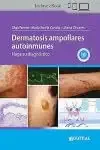 Dermatosis ampollares autoinmunes: Haga su diagnóstico