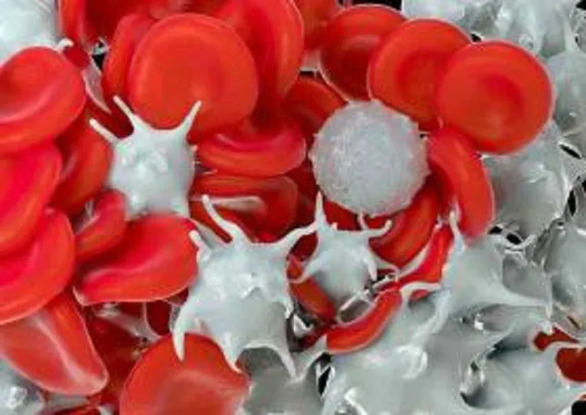 2025 Tutorial on Neoplastic Hematopathology