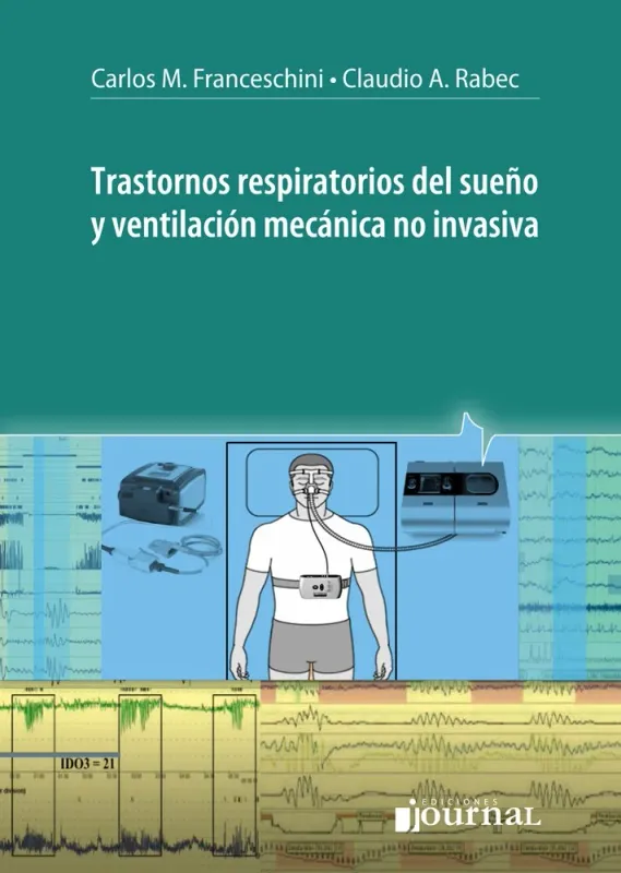 Trastornos respiratorios del sueño y ventilación mecánica no invasiva