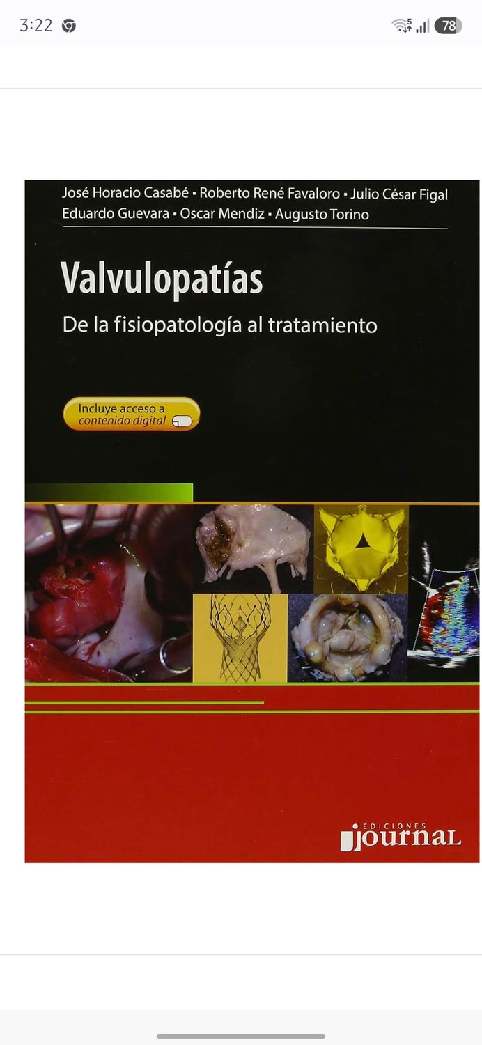 Valvulopatías. De la fisiopatología al tratamiento (Spanish Edition)