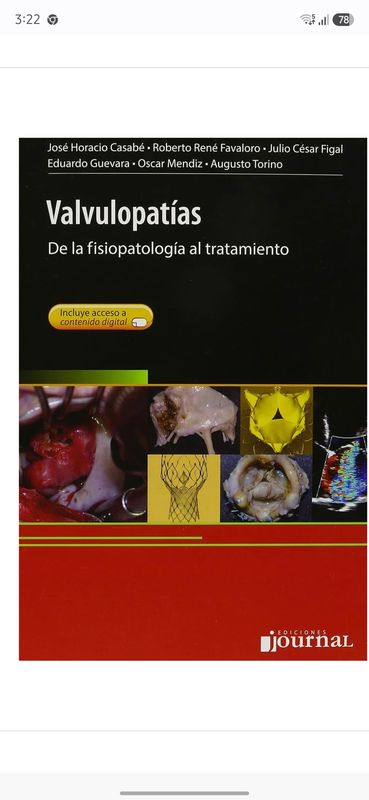 Valvulopatías. De la fisiopatología al tratamiento (Spanish Edition)