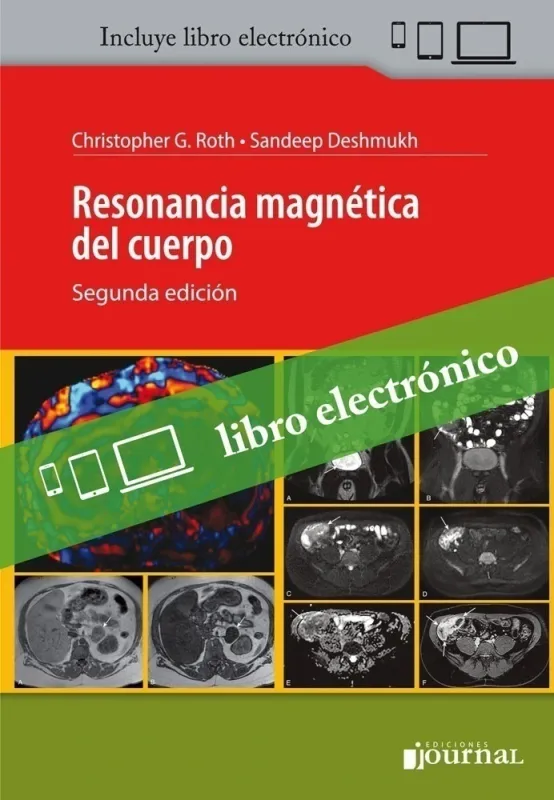 Resonancia Magnetica Del Cuerpo, 2nd Edition
