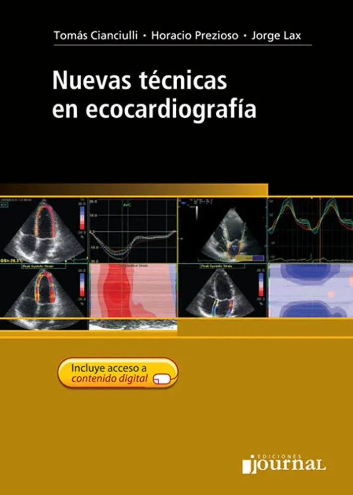 Nuevas tecnicas en Ecocardiografia (Spanish Edition)