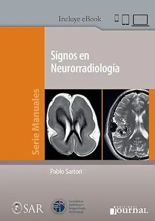 Signos en Neurorradiología