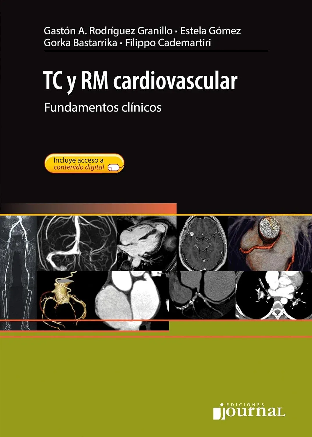 TC y RM cardiovascular (Spanish Edition)