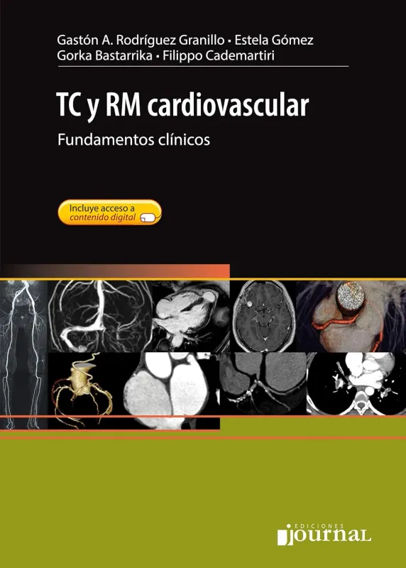 TC y RM cardiovascular (Spanish Edition)
