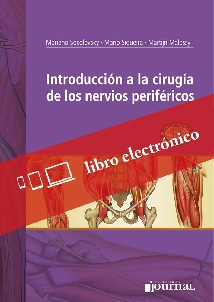 Introducción A La Cirugía De Los Nervios Periféricos