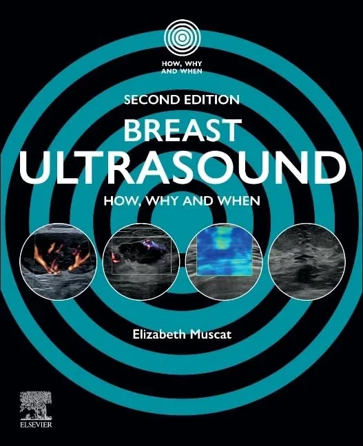 Breast Ultrasound: How, Why and When, 2nd edition