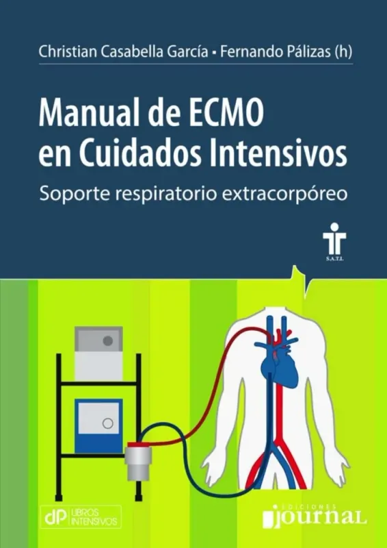 Manual Ecmo En Cuidados Intensivos. Soporte Respiratorio Extracorpóreo