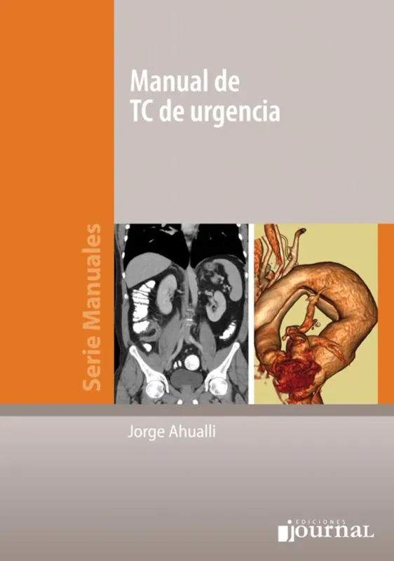 Manual De Tc De Urgencias