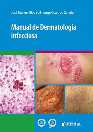 Manual de dermatología infecciosa