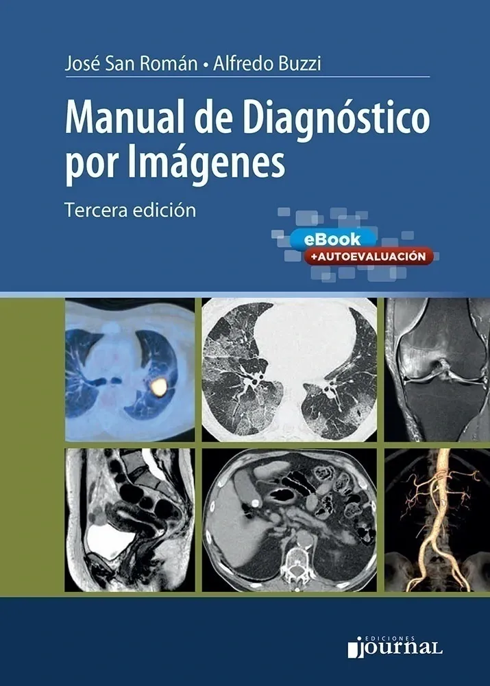Manual de Diagnóstico por Imágenes, 3a edición