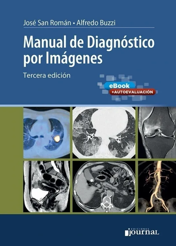Manual de Diagnóstico por Imágenes, 3a edición