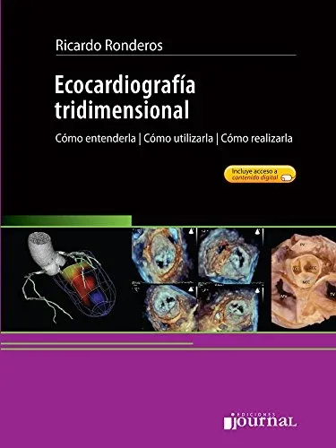 Ecocardiografía tridimensional. Cómo entenderla, Cómo utilizarla, Cómo realizarla