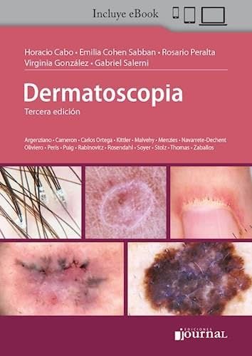 Dermatoscopia, 3a edición