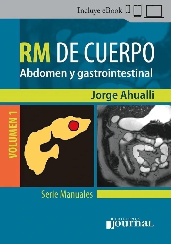 Manual de RM de Cuerpo Volumen 1: Abdomen y gastrointestinal