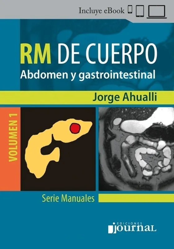 Manual de RM de Cuerpo Volumen 1: Abdomen y gastrointestinal