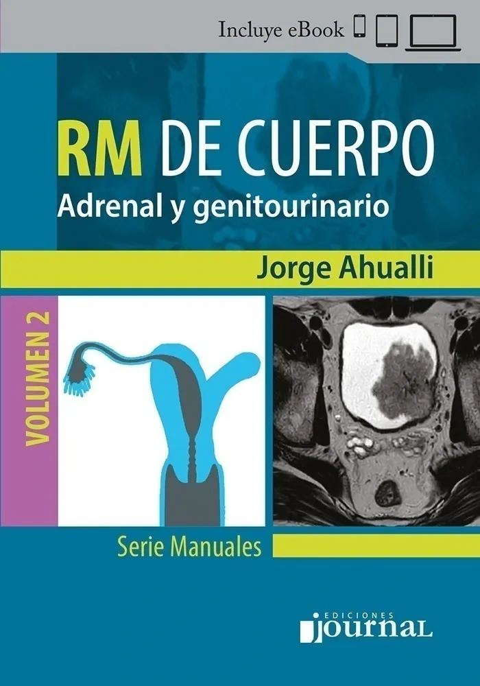 Manual de RM de Cuerpo Volumen 2: Adrenal y genitourinario