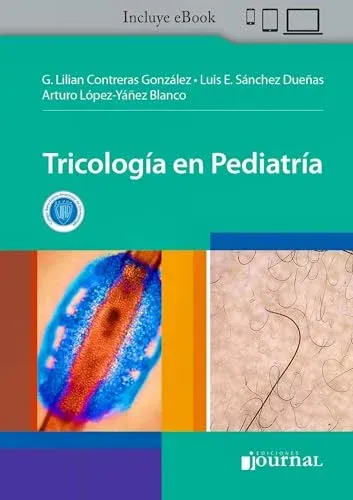 Tricología en Pediatría