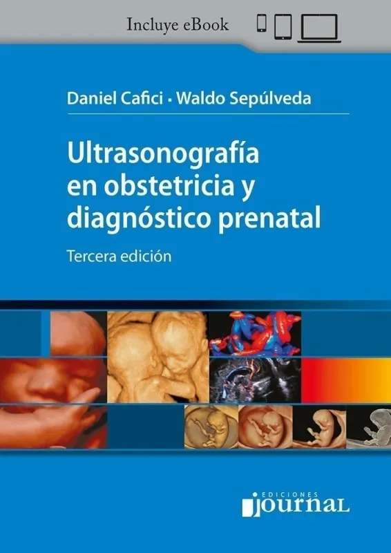 Ultrasonography in Obstetrics and Prenatal Diagnosis, 3rd Edition