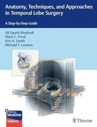 Anatomy, Techniques, and Approaches in Temporal Lobe Surgery: A Step-by-Step Guide (