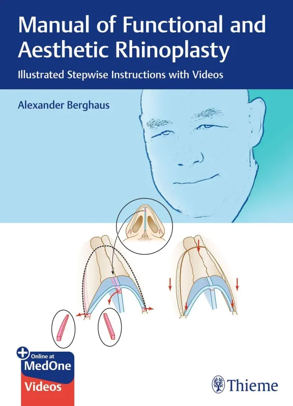 Manual of Functional and Aesthetic Rhinoplasty: Illustrated Stepwise Instructions with Videos