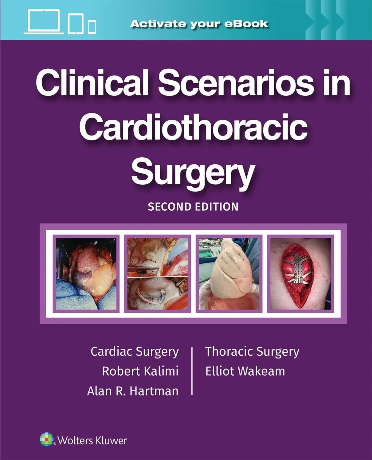 Clinical Scenarios in Cardiothoracic Surgery, 2nd Edition