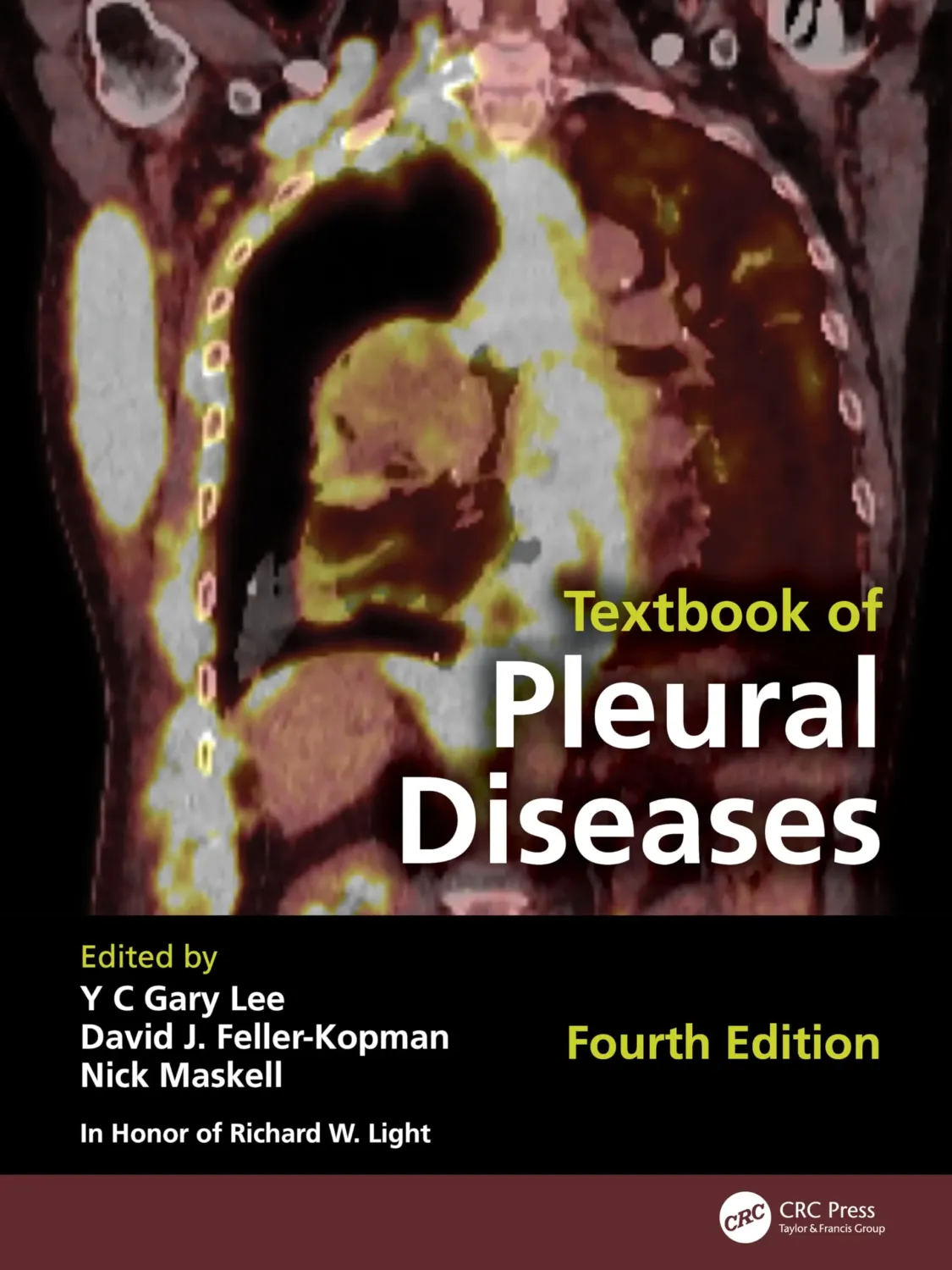 Textbook of Pleural Diseases, 4th Edition