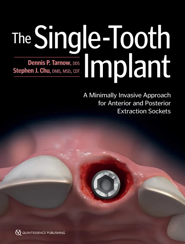 The Single-Tooth Implant:: A Minimally Invasive Approach for Anterior and Posterior Extraction Sockets
