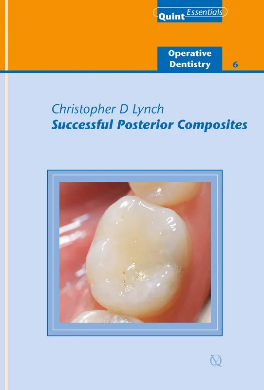 Successful Posterior Composites: Operative Dentistry - 6 (QuintEssentials of Dental Practice Book 32)