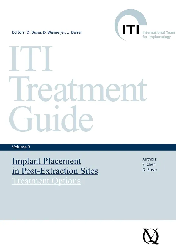 Implant Placement in Post-Extraction Sites: Treatment Options (ITI Treatment Guide Series Book 3)