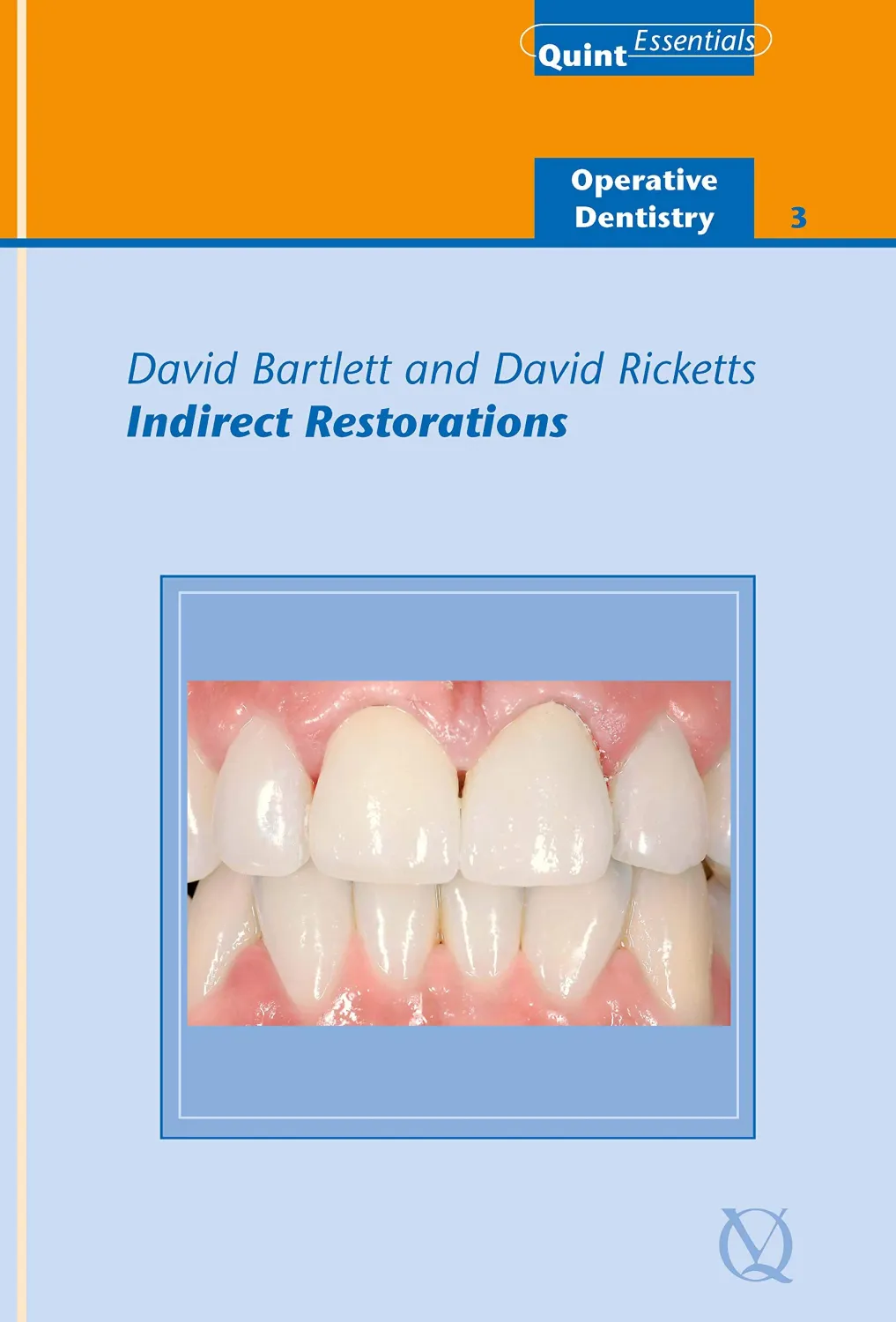 Indirect Restorations (QuintEssentials of Dental Practice Book 25)