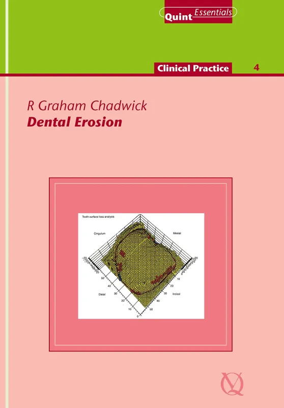 Dental Erosion (QuintEssentials of Dental Practice Book 34)