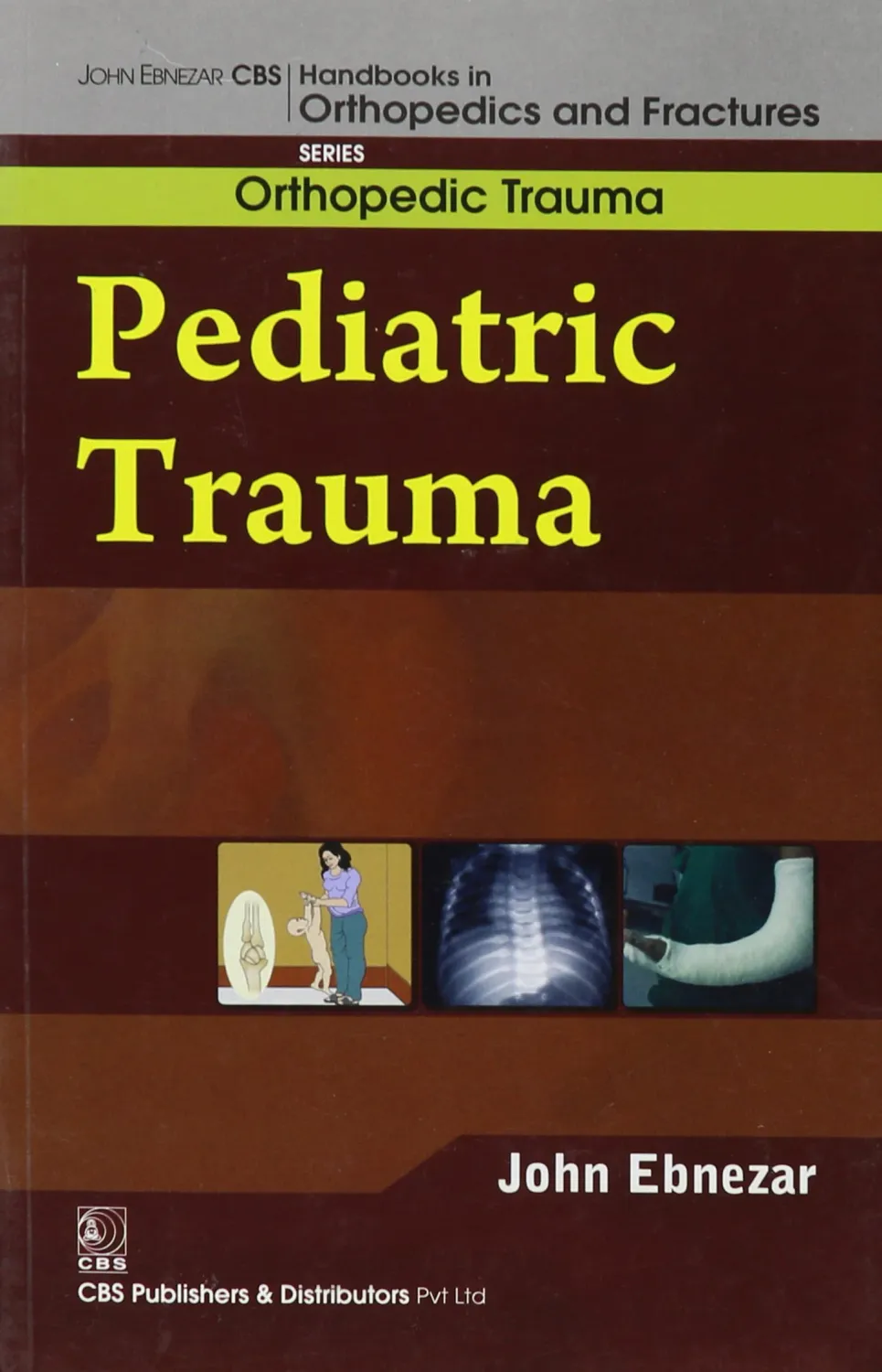 CBS Handbooks in Orthopedics and Factures: Orthopedic Trauma: Pediatric Trauma