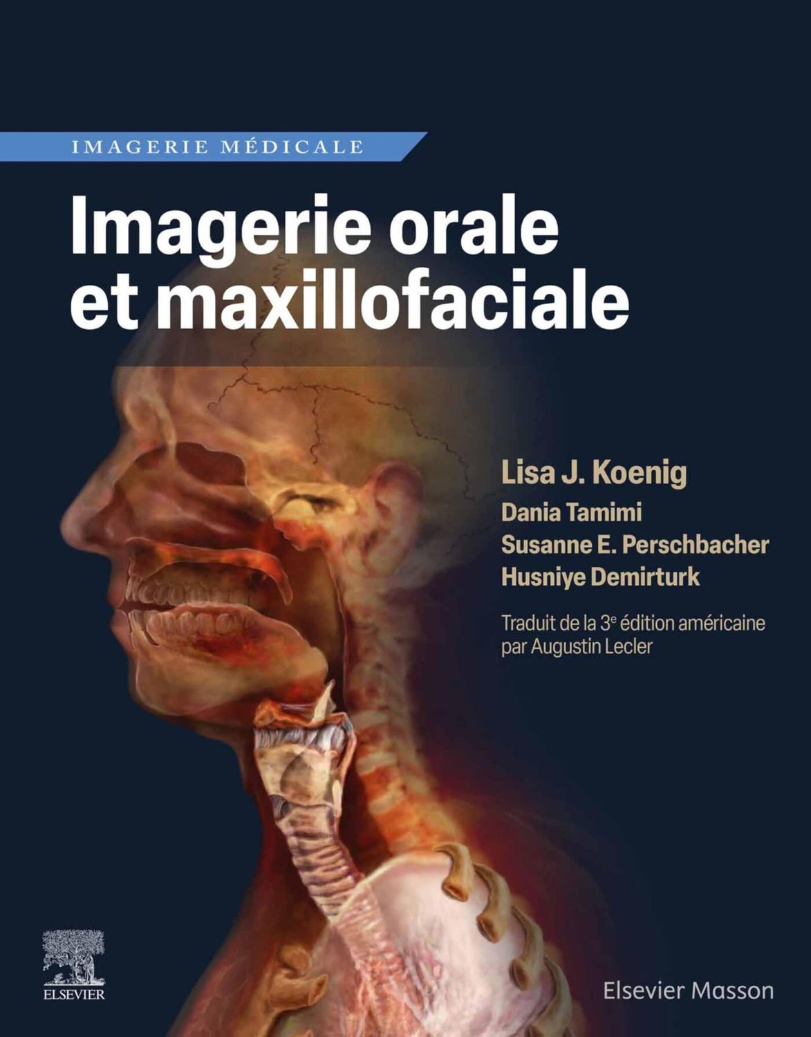 Imagerie orale et maxillofaciale (French Edition)