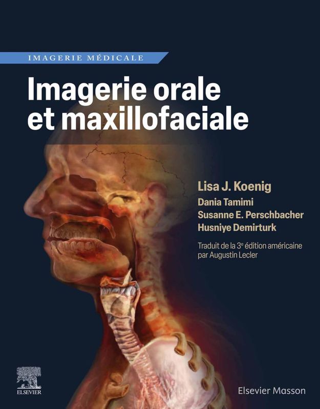 Imagerie orale et maxillofaciale (French Edition)
