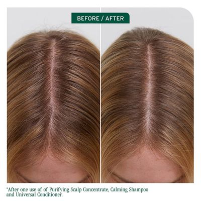 Biolage - Scalp Sync - Shampoing Calmant (400ml)
