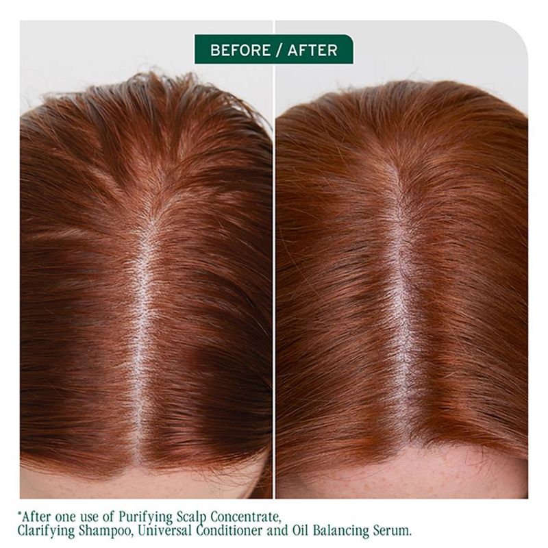 Biolage - Scalp Sync - Shampoing Clarifiant (1L)