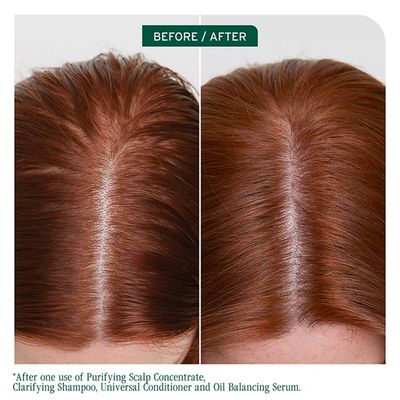Biolage - Scalp Sync - Shampoing Clarifiant (1L)