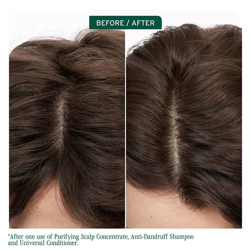Biolage - Scalp Sync - Shampoing Antipelliculaire (1L)