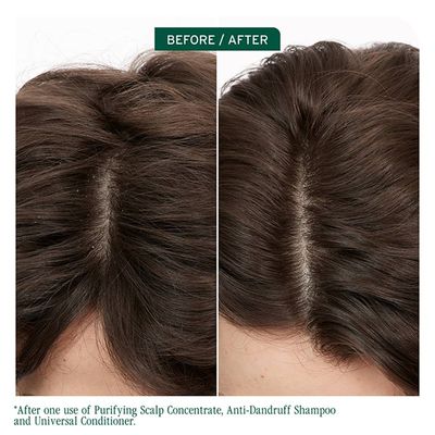 Biolage - Scalp Sync - Shampoing Antipelliculaire (400ml)
