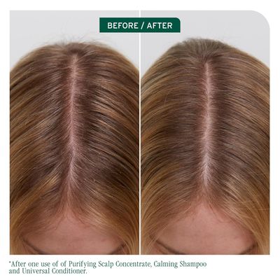 Biolage - Scalp Sync - Revitalisant Universel (1L)