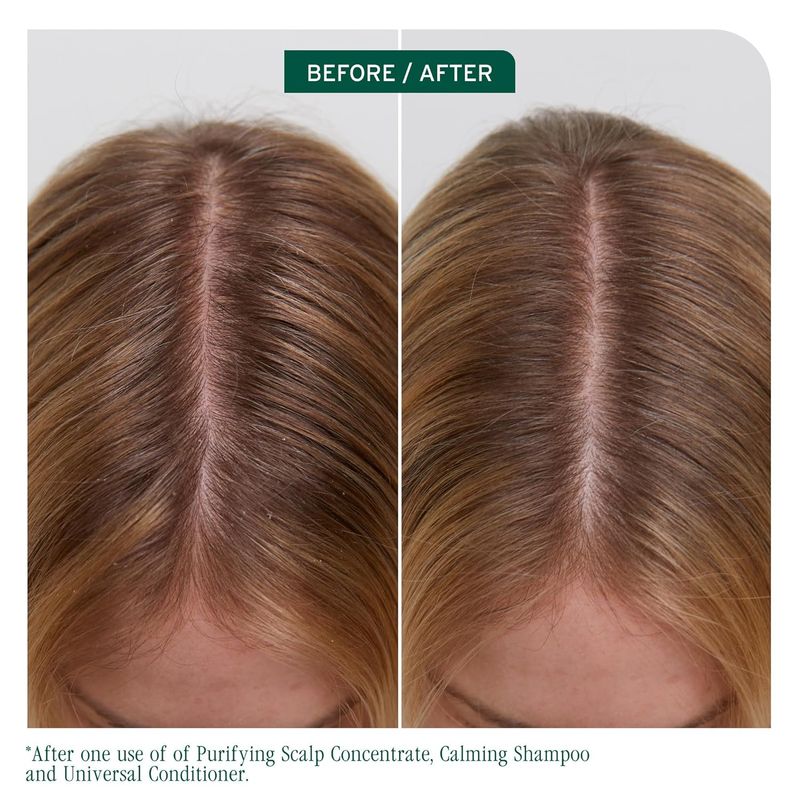 Biolage - Scalp Sync - Revitalisant Universel (236ml)